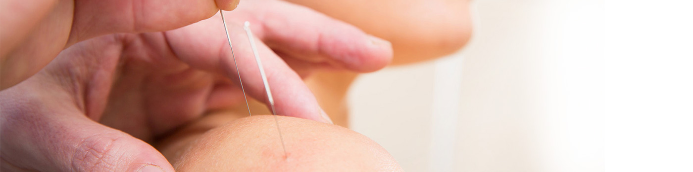 Acupuncture Gold Coast Clinic